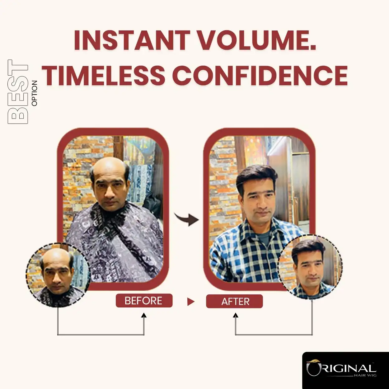 Mono 3.0 Hair Patch Natural Movement Real Hair Finish Lightweight WearNatural Black Mono 3.0 Hair Patch Easy Fix with Tape Glue and Clips